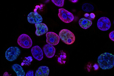 Home diagnostic lab case gallery 6